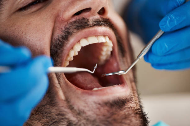 Best Walk-In Emergency Dental Services in Santa Rita Ranch, TX